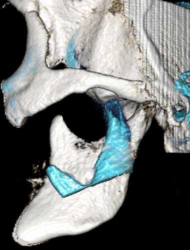 TMJ CBCT Portfolio